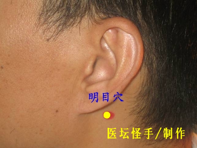 王文遠(yuǎn)平衡針灸穴位圖 - 3396815 - 3396815博愛(ài)