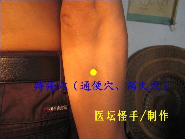 王文遠(yuǎn)平衡針灸穴位圖 - 3396815 - 3396815博愛(ài)