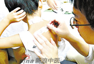 灸法的種類  你知道多少？